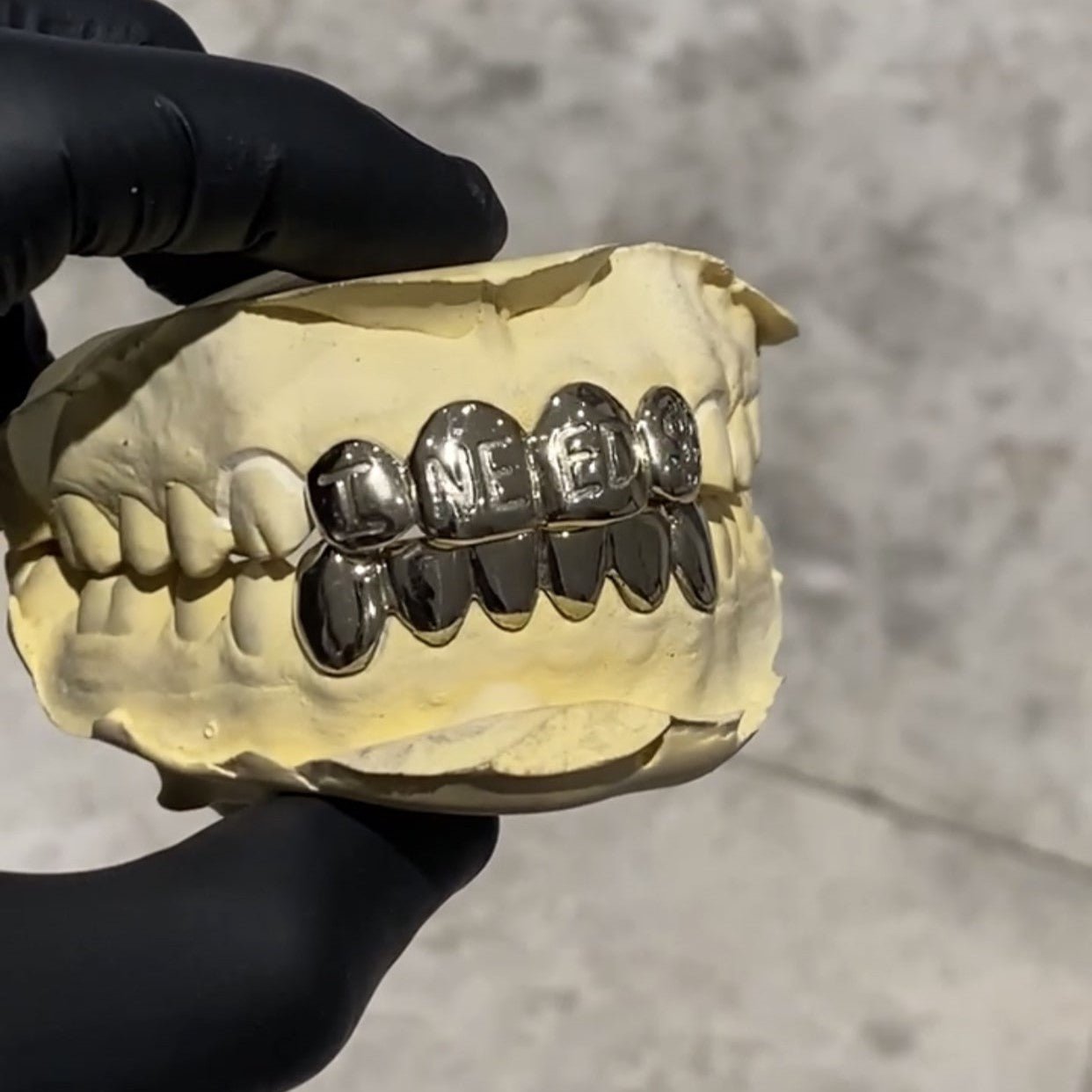 Dental Gold Grillz - GLIDER JEWELS