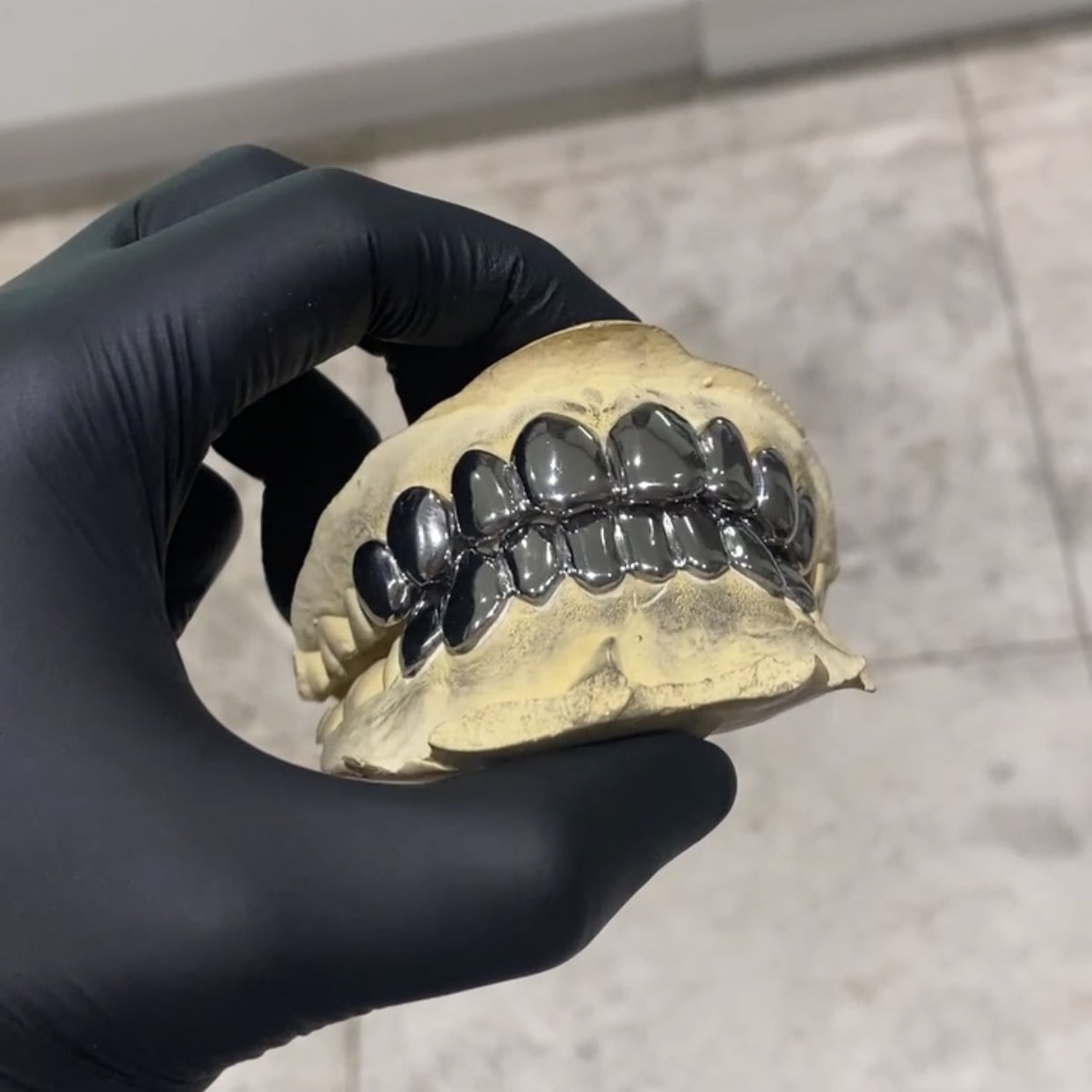 Dental Gold Grillz - GLIDER JEWELS