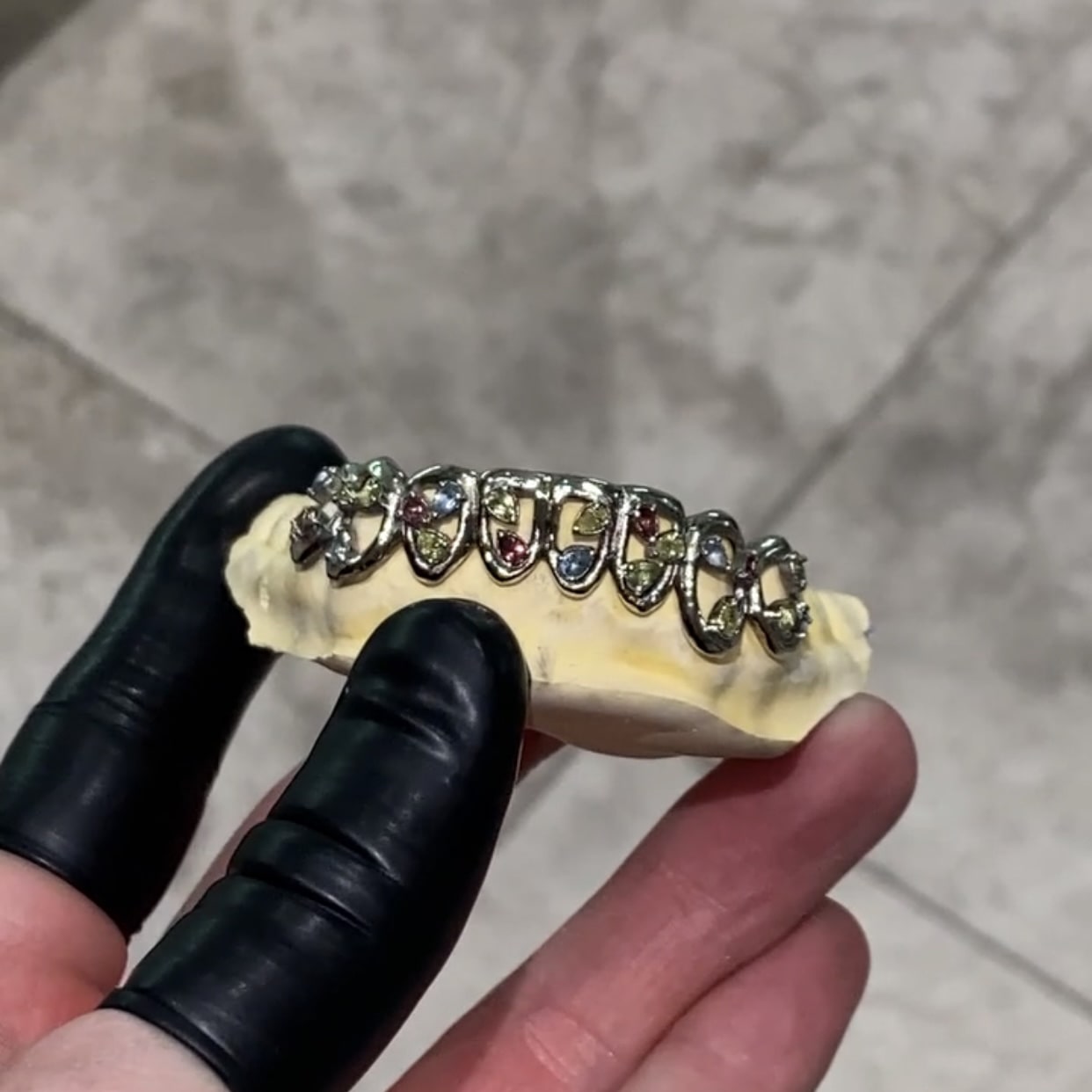 VVS Diamond Grillz - GLIDER JEWELS