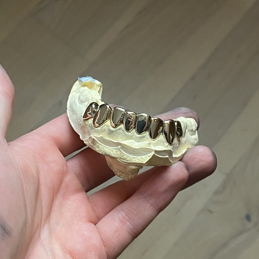 Gold Grillz