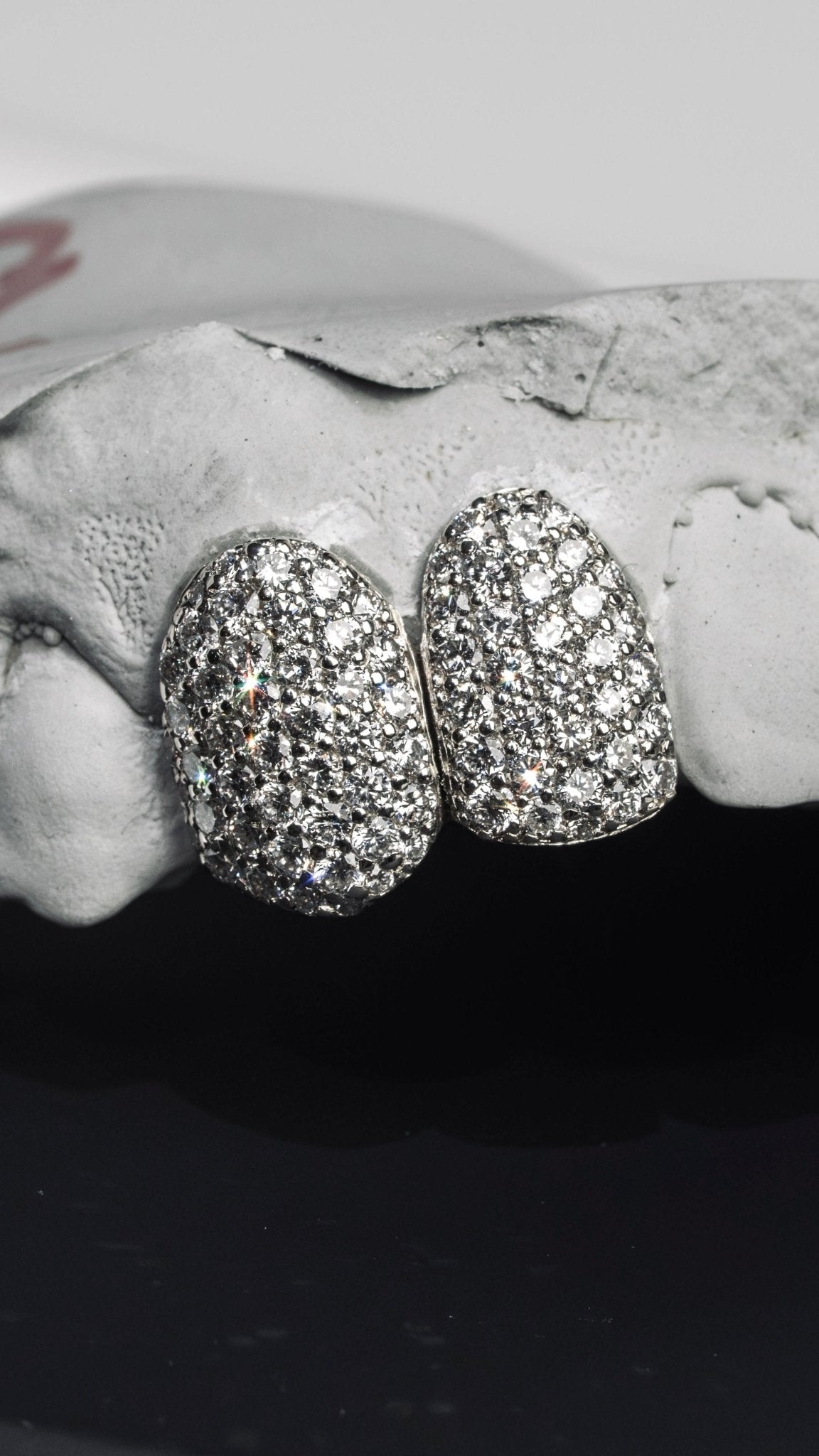 Gold VVS Diamond Grillz - GLIDER JEWELS