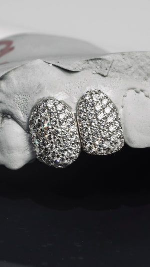 Gold VVS Diamond Grillz - GLIDER JEWELS