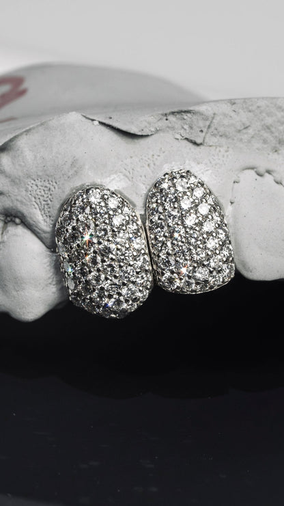 Gold VVS Diamond Grillz - GLIDER JEWELS