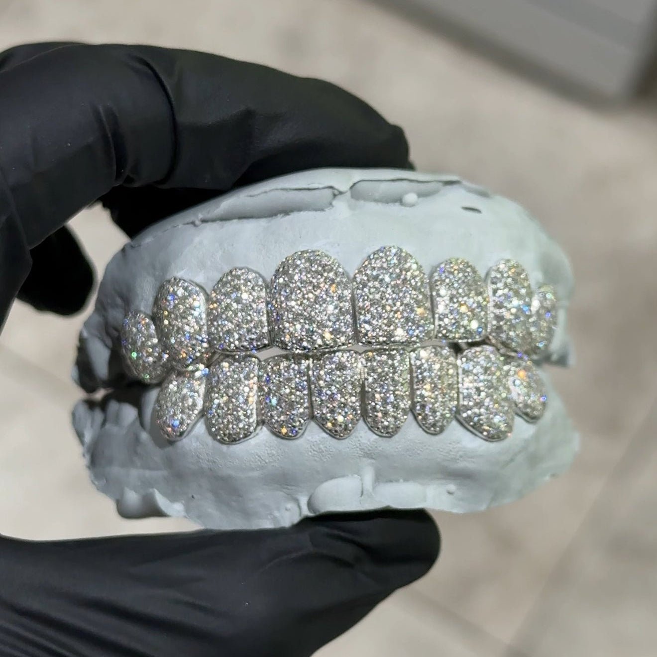 Gold VVS Diamond Grillz - GLIDER JEWELS