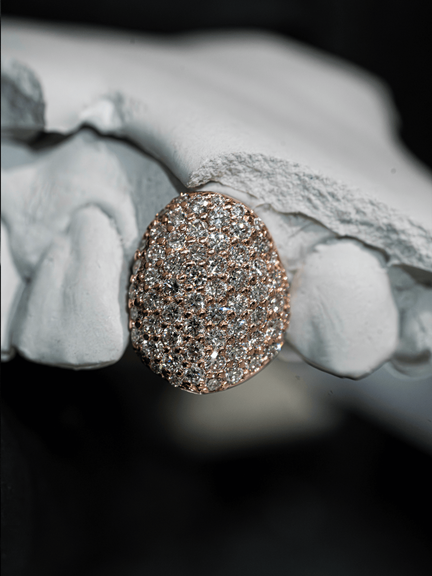 Gold VVS Diamond Grillz - GLIDER JEWELS