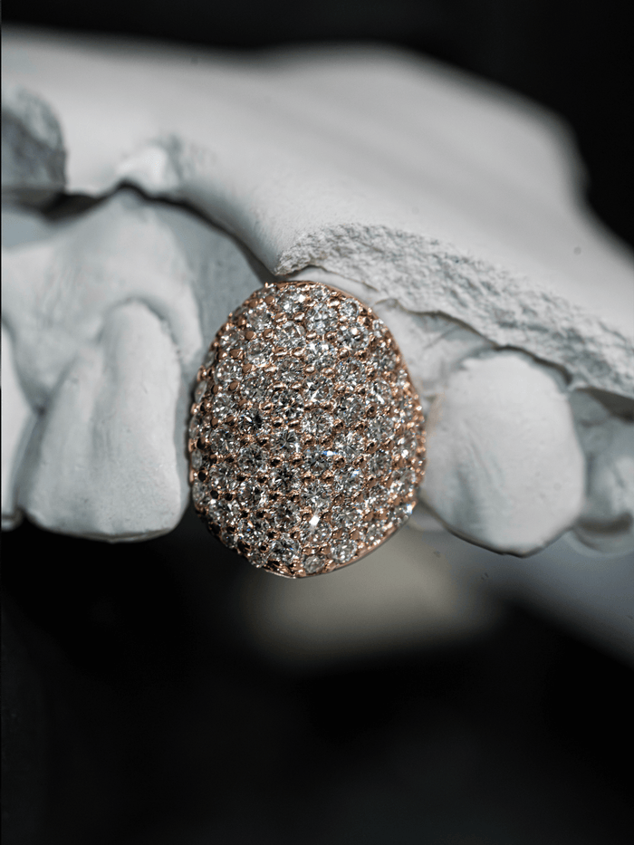 Gold VVS Diamond Grillz - GLIDER JEWELS