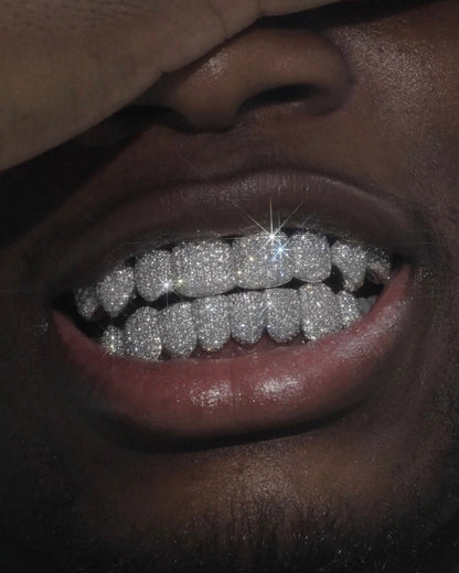 Grillz Moulding Appointment - GLIDER JEWELS