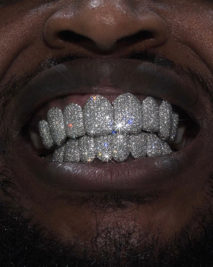 Grillz Moulding Appointment - GLIDER JEWELS
