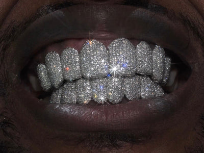 Grillz Moulding Appointment - GLIDER JEWELS